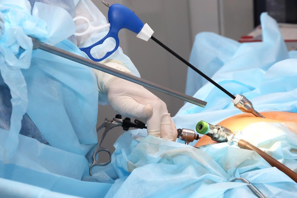 Laparoscopic Hernia Surgery