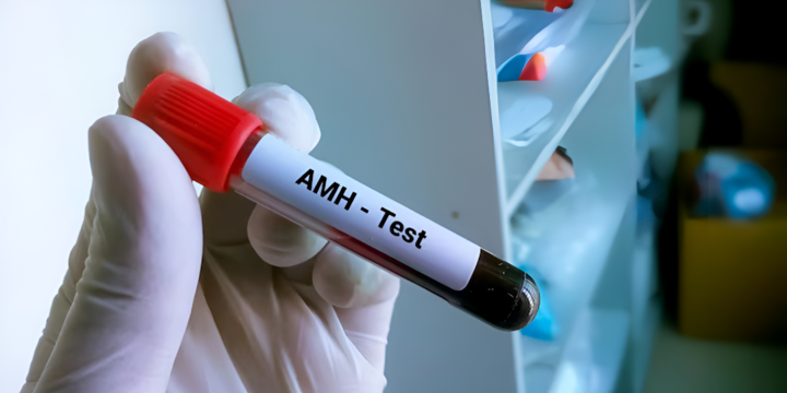 amh-test